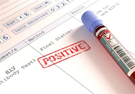 Hiv Positive Photos and Images .